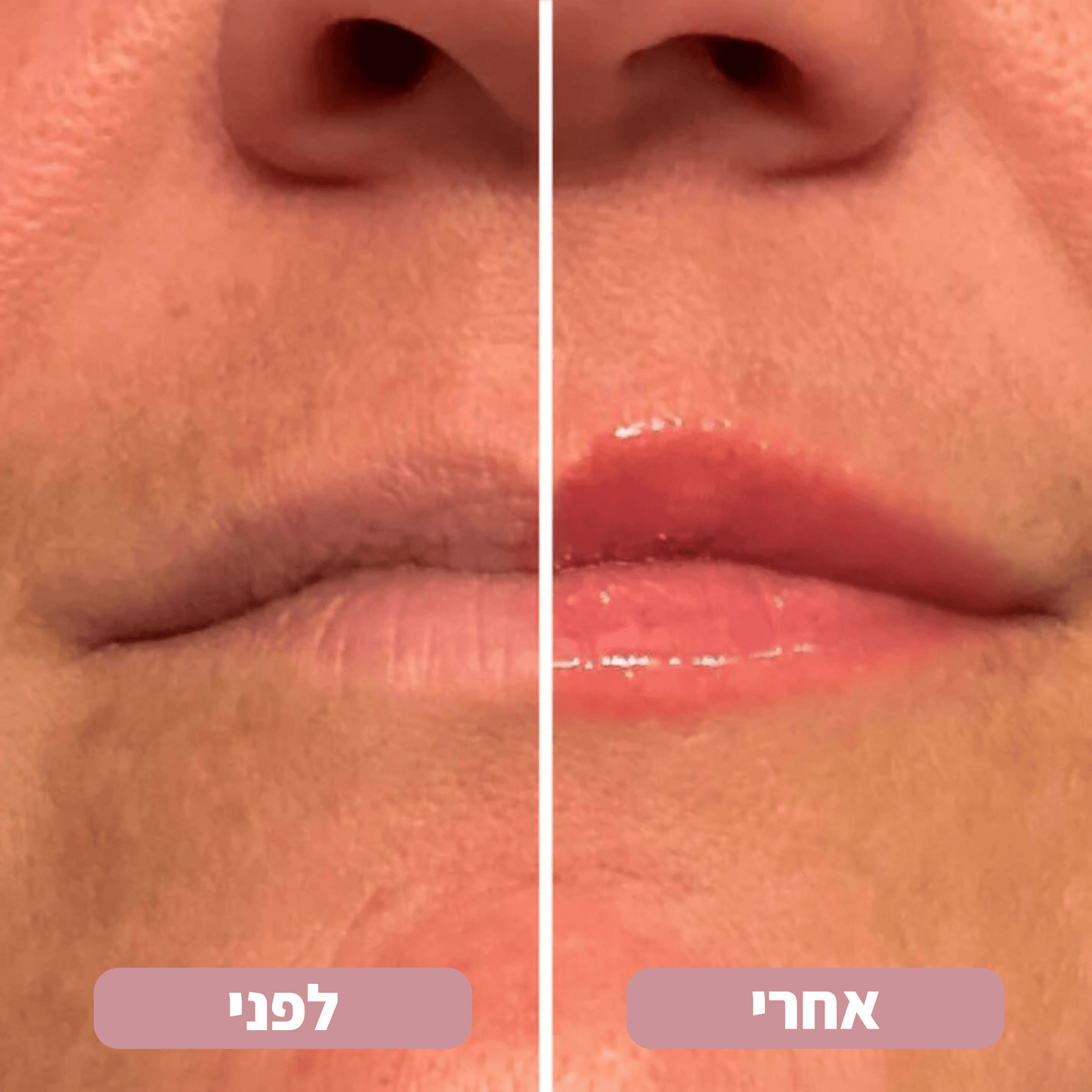 Lip Glow® - מנפח שפתיים ומעשיר בלחות